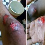 MARGINAIS ROUBAM MOTORIZADA DE UM HOMEM E DEIXAM-O FERIDO